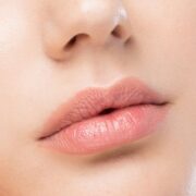 Filler per labbra risultati naturali con acido ialuronico bioriassorbibile