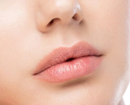 Filler per labbra risultati naturali con acido ialuronico bioriassorbibile