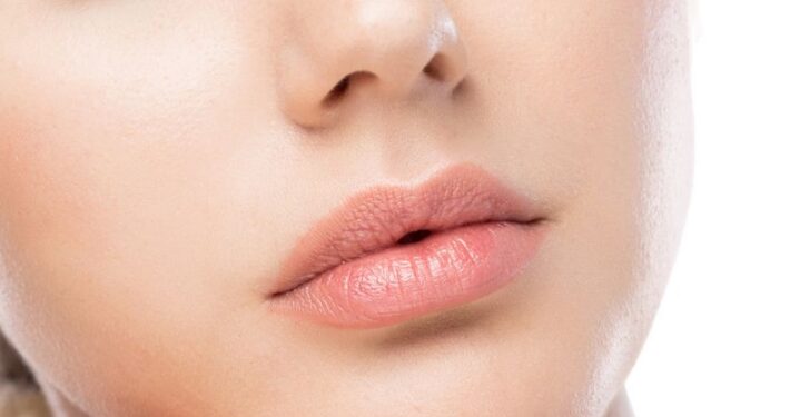 Filler per labbra risultati naturali con acido ialuronico bioriassorbibile