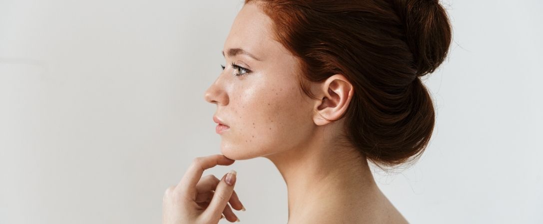 Profilo perfetto armonizzare il volto con l'acido ialuronico